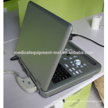 Máquina de ultrasonido digital médica / ultrasonido 4D